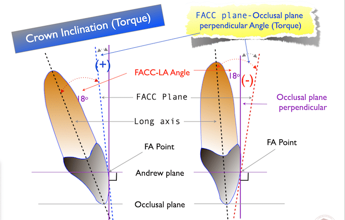 FACC and Long Axis blog